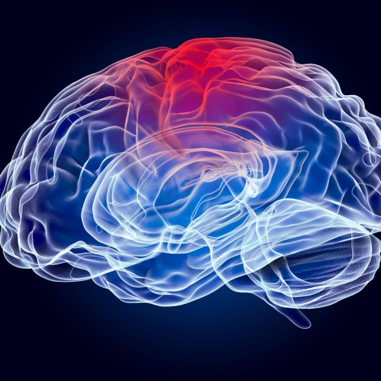 Concussion in High School Sports